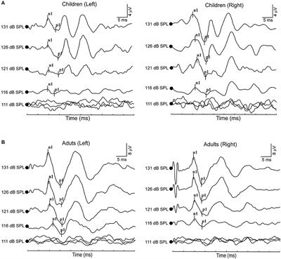 Effects of acoustic stimulation intensity on air-conducted vestibular evoked myogenic potential in children